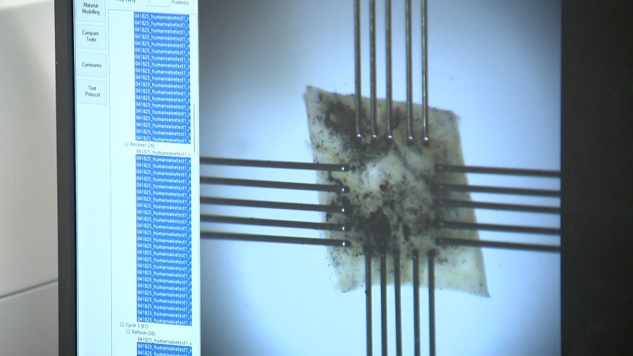 USF researchers work on solution for kids with heart defects: living heart valves