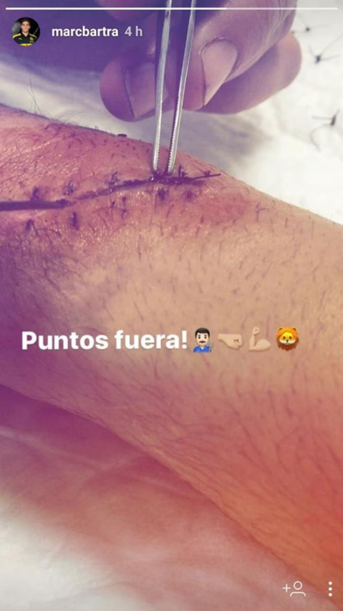 Mikel Merino: 