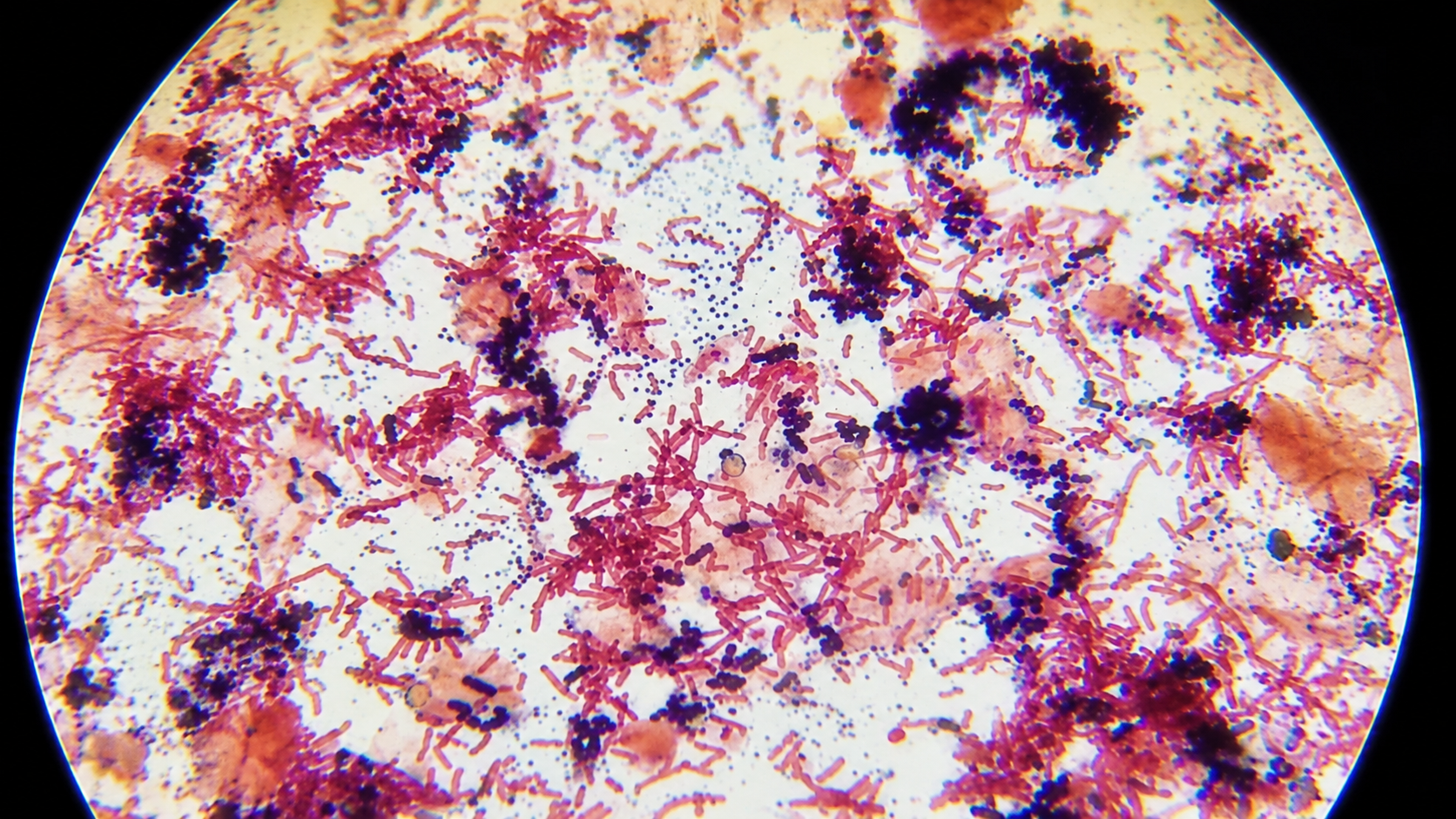 Microscope experiments uncover hidden microorganisms and unexpected ...