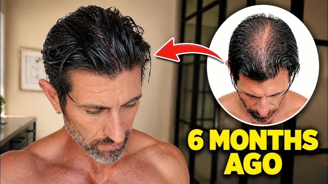 He thought he was going bald… then he tried everything he could find to ...