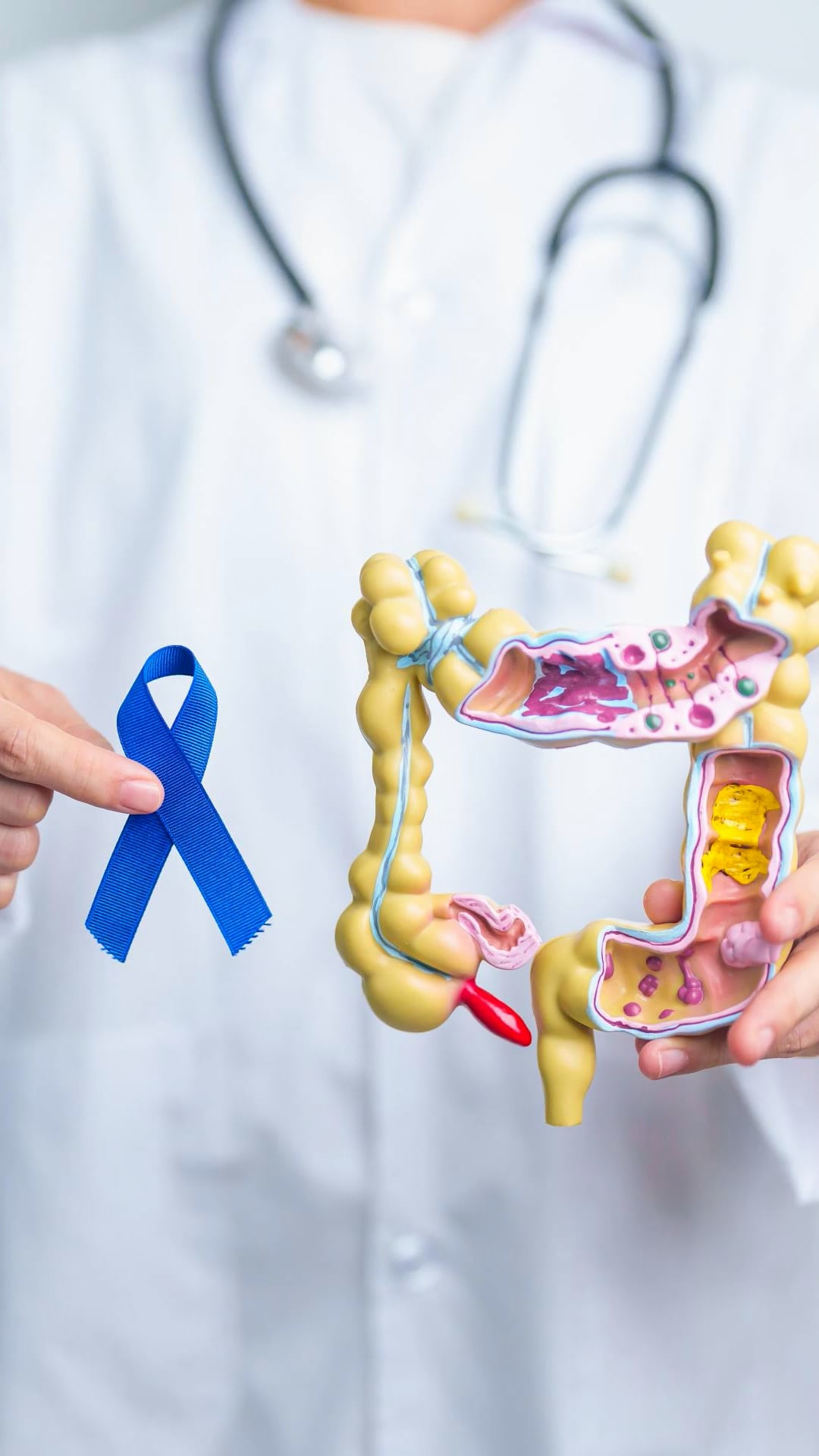 5 subtle warning signs of colorectal cancer that many people ignore