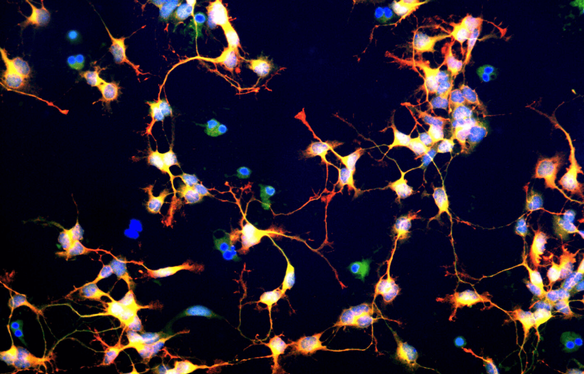 New biological data center uses millions of living human brain cells to ...