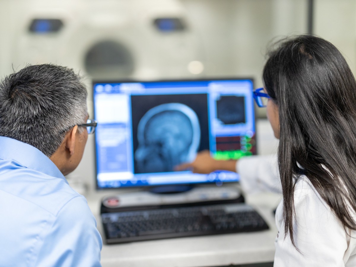 Everyday foods linked to hidden signs of brain damage