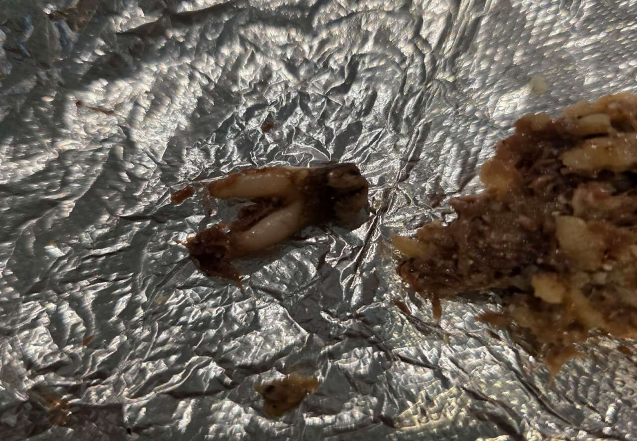 Torchy's Tacos sued by Texas woman who claims she found a cow tooth in ...