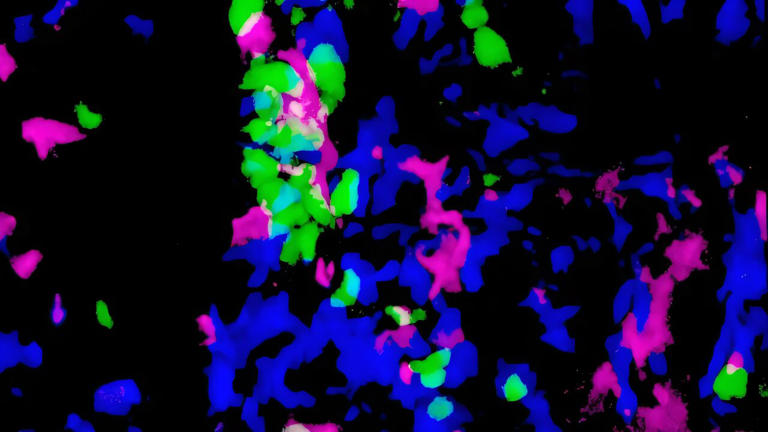 The same immune cells play opposing roles in tissue regeneration's ...