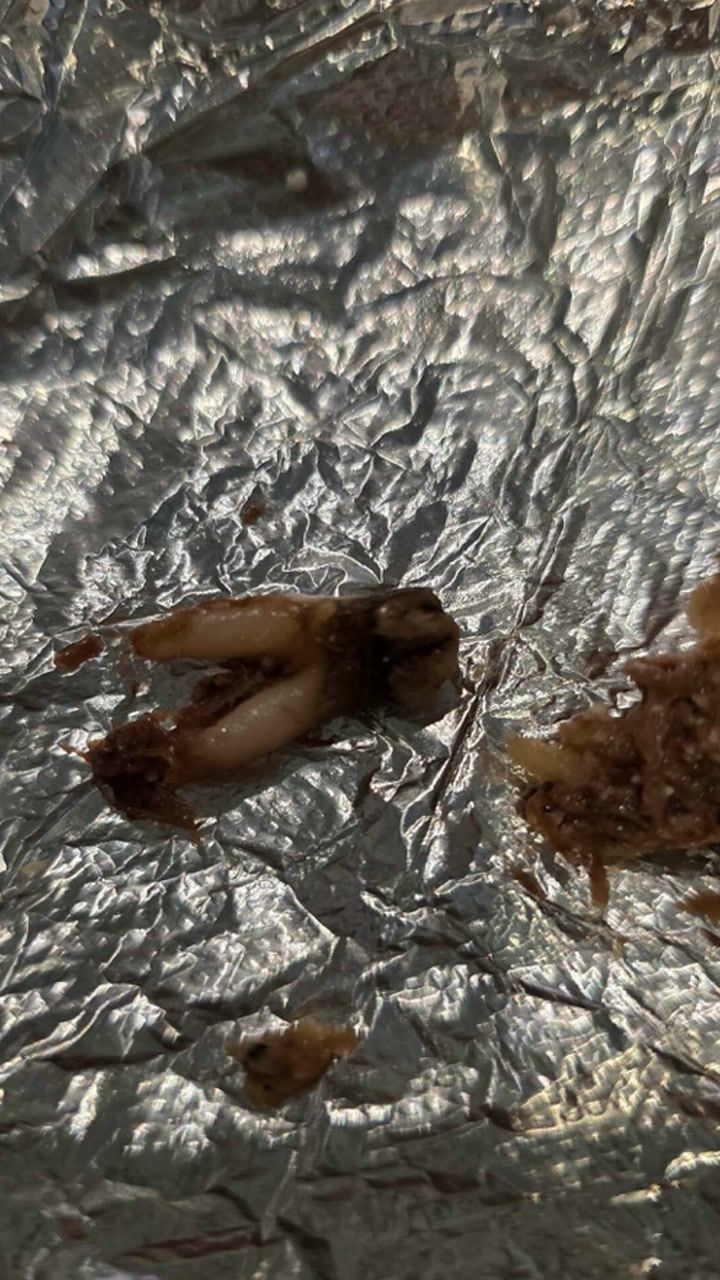 Woman says a cow tooth was in her Torchy's taco. Now she's suing.