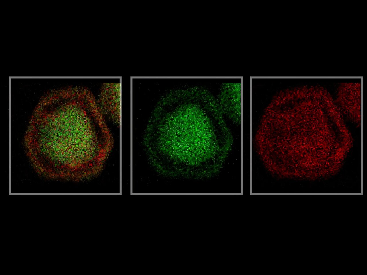 One-step rapid syphilis test uses layered nanoparticles to detect ...