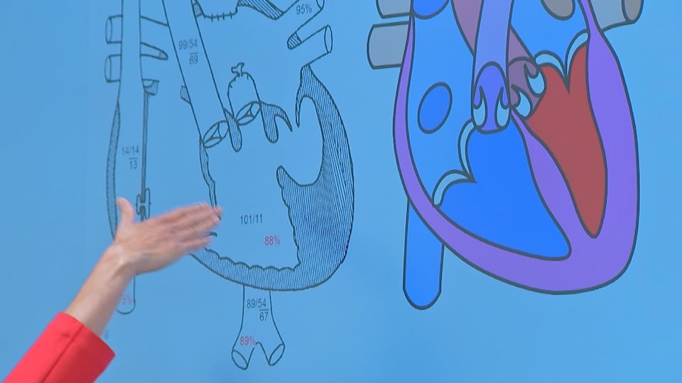 FDA approves first heart valve designed to grow with kids born with ...