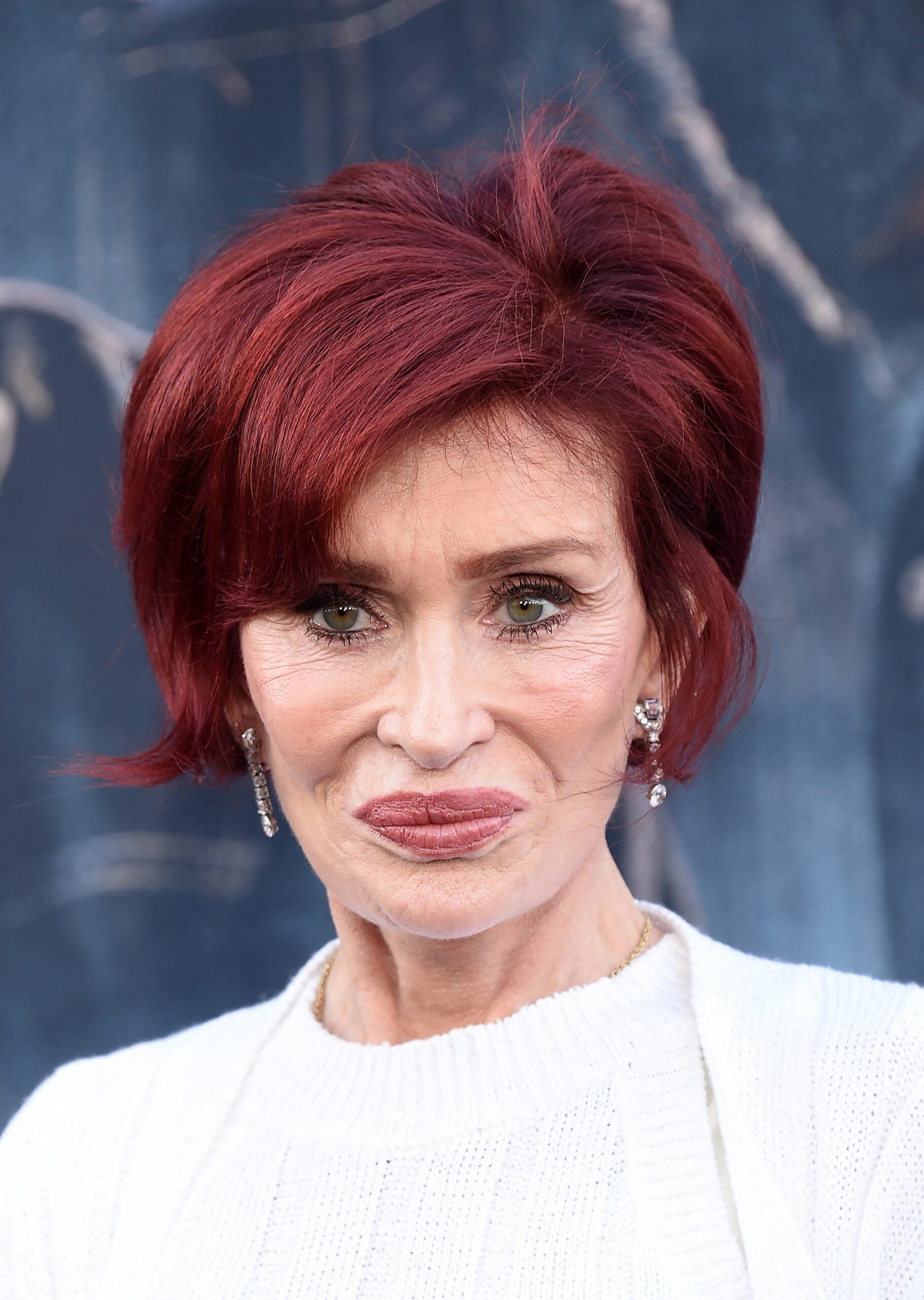 Sharon Osbourne reveals facial dent after botched cosmetic procedure