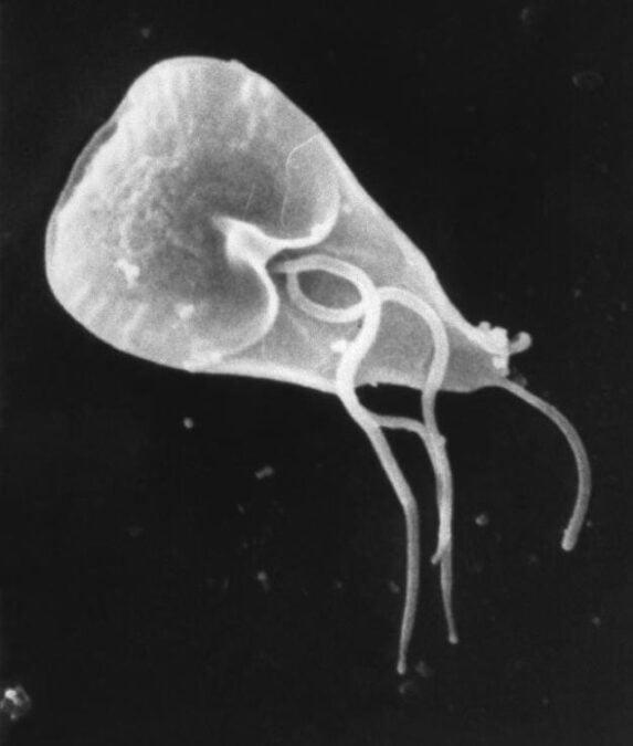 Cat owners: There's a parasite you've probably never heard of, and it's ...