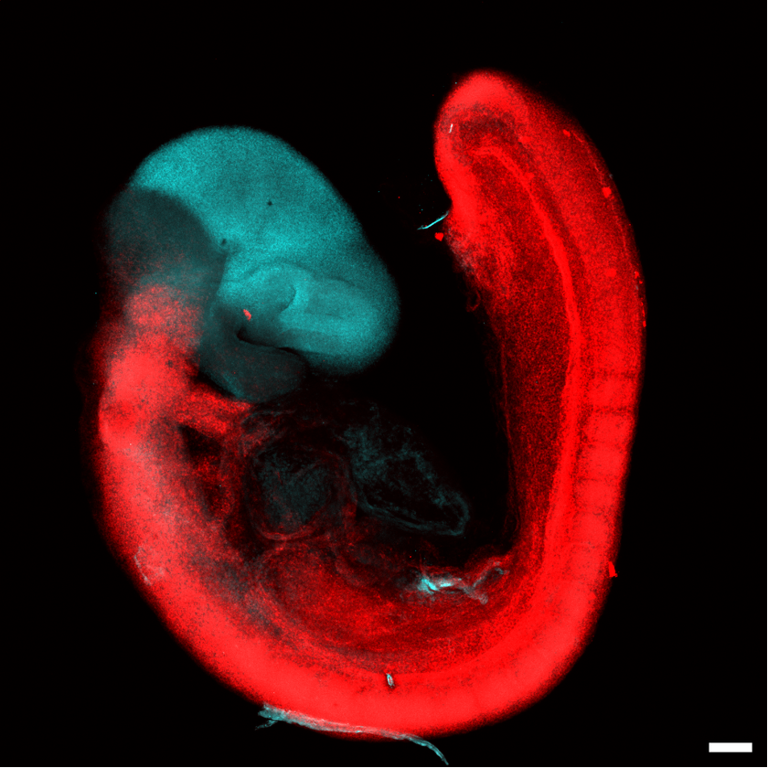 Is the brain actually 2 nervous systems smooshed together? A new study ...