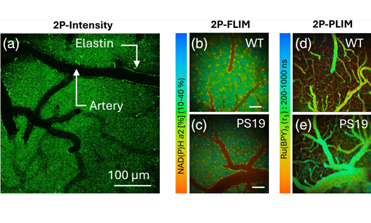 Optical imaging links altered metabolism and oxygen use in Alzheimer's ...