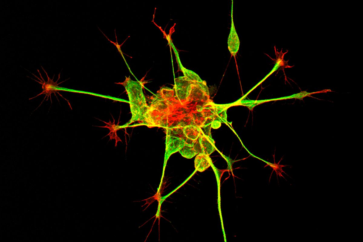 Tiny human mini-brains that can read Braille give us a glimpse into the future of biohybrid computers
