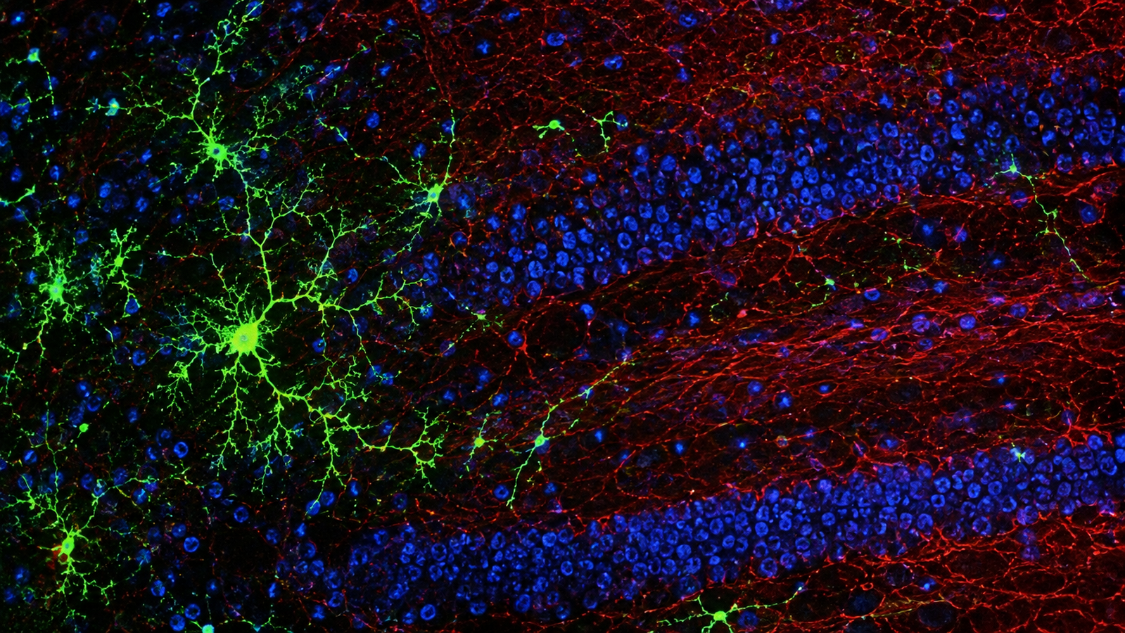 Un gene potrebbe cambiare il modo in cui ripariamo le difese del cervello