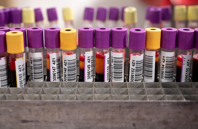 Men are lining up for a new on-the-go blood test that measures testosterone