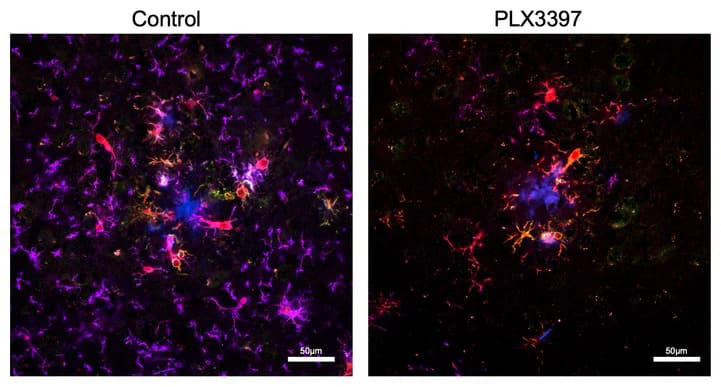 The real culprit behind sleep loss in Alzheimer’s isn’t the one we thought