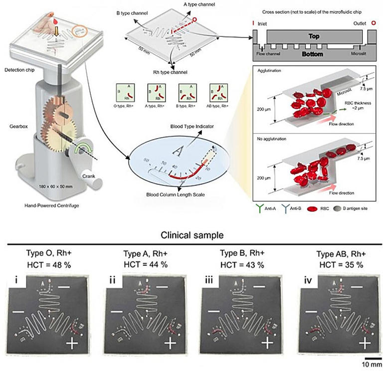 Hand-cranked device tells blood type and red cell levels in 1 minute