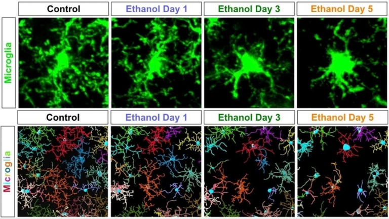Alcohol doesn't just affect neurons – it triggers immune cells to ...