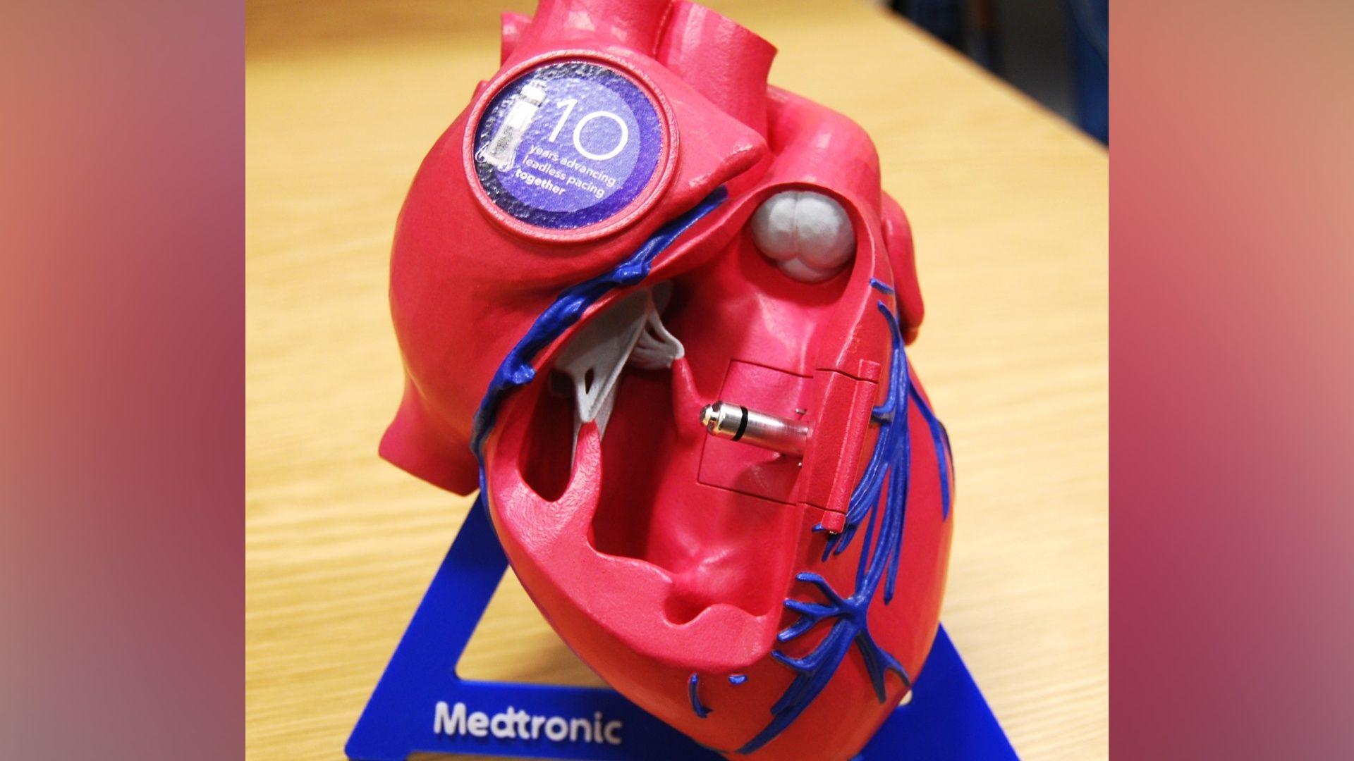 Hospital recognised for tiny pacemaker work