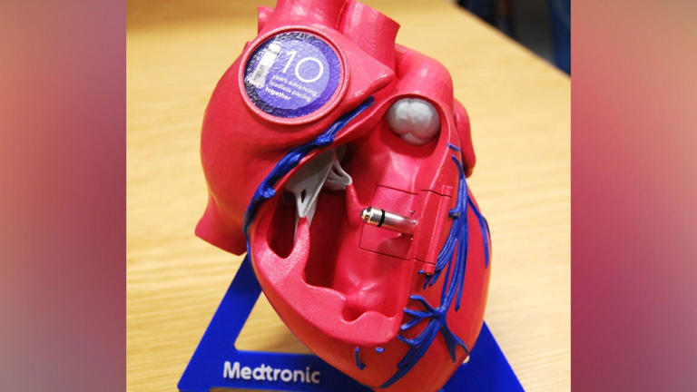 Hospital recognised for tiny pacemaker work