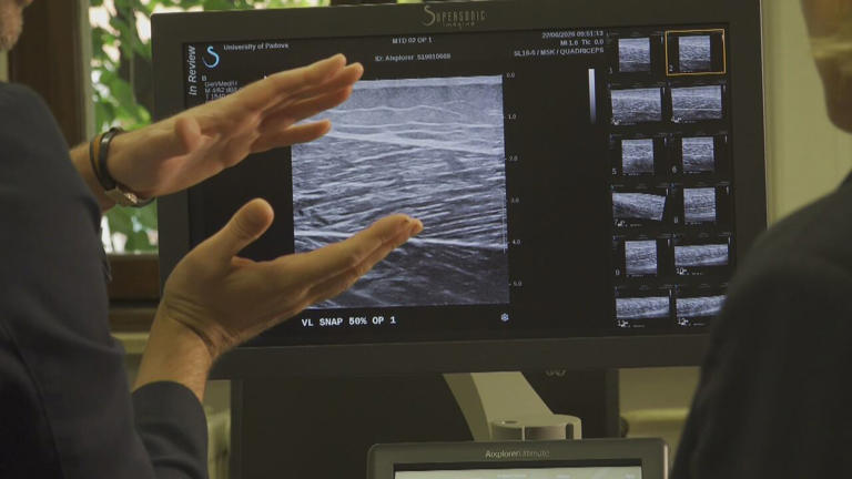 Could this 93-year-old sprinter's muscles hold clues to healthy aging ...