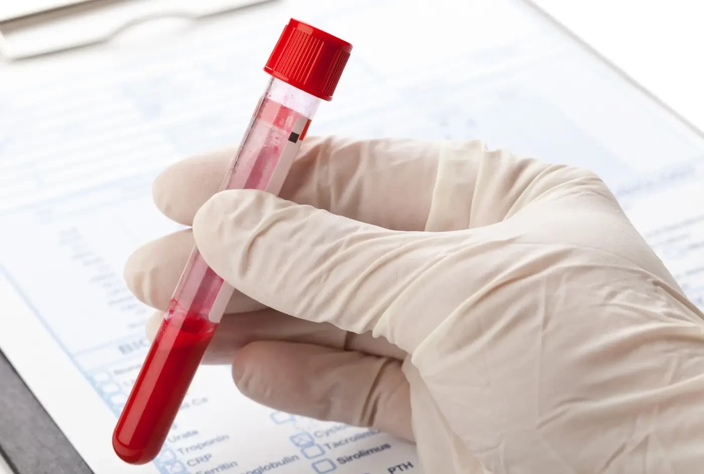 Kaplan Medical Center laboratory allegedly takes patients' blood ...