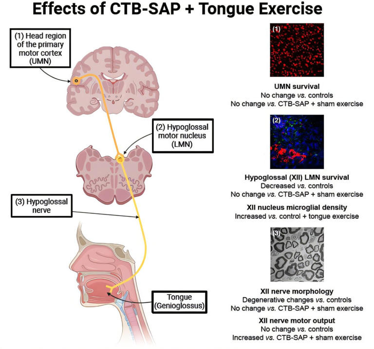 Tongue exercises for ALS patients show promise in preclinical study
