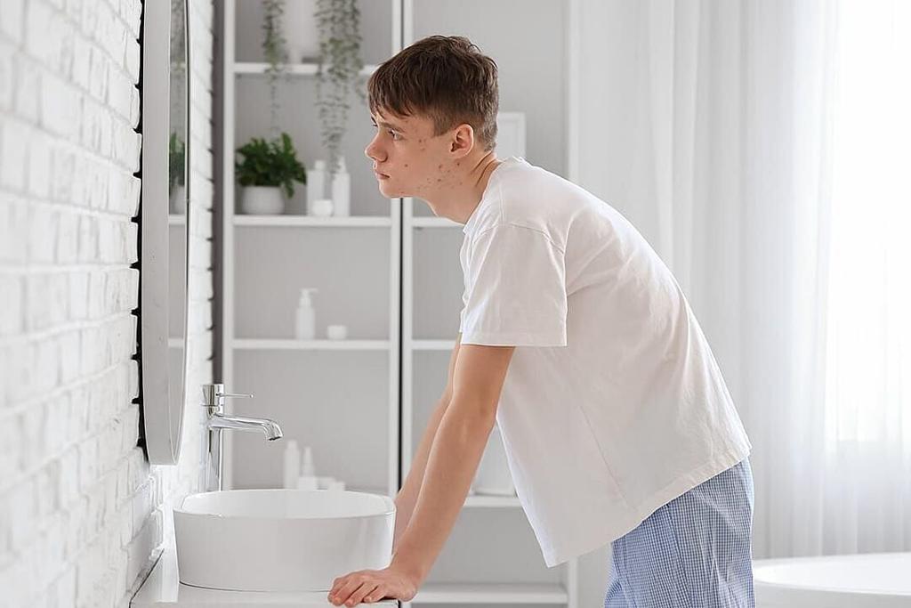7 proven acne treatments for teens