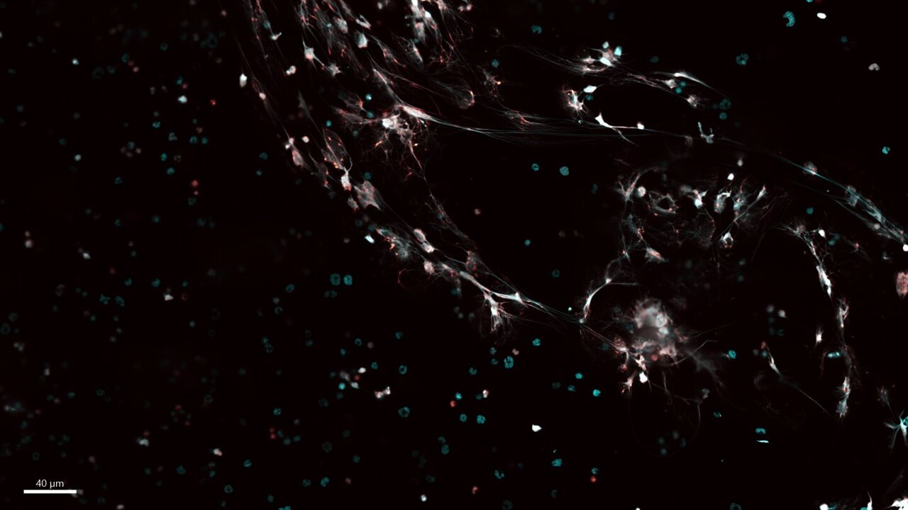 Embryos harbor immune cells that already perform adult-like defense ...
