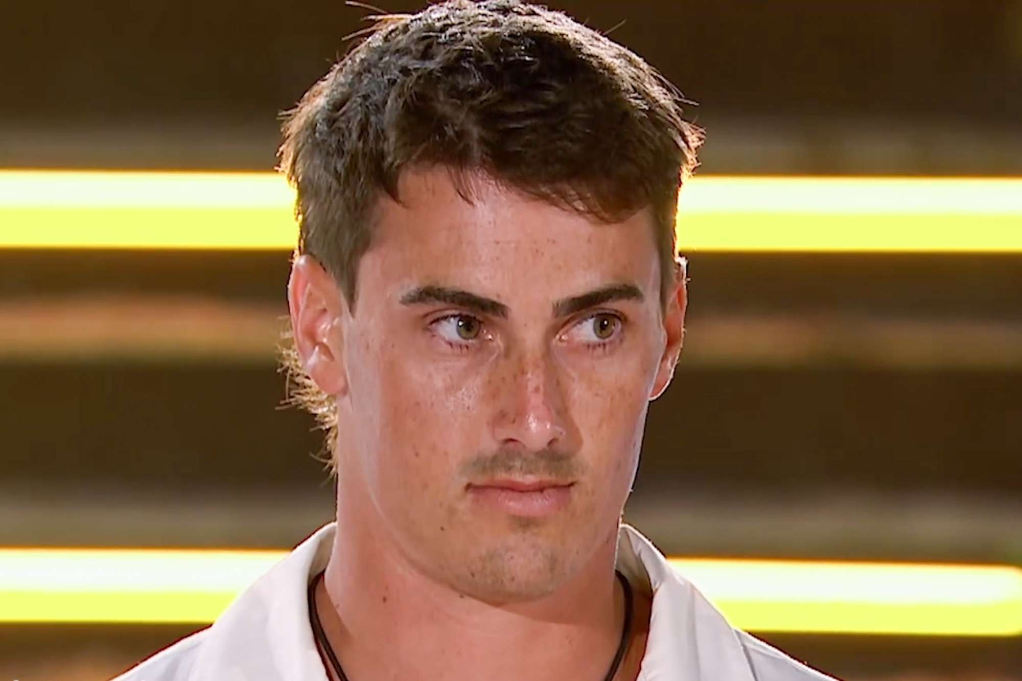 Love Island Australia star suffers third-degree burns, brain bleeding ...