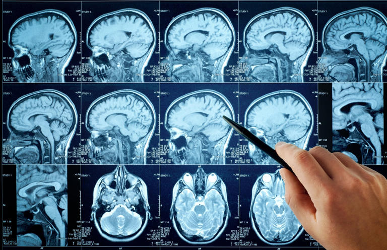 Lab-grown human mini-brains can read Braille