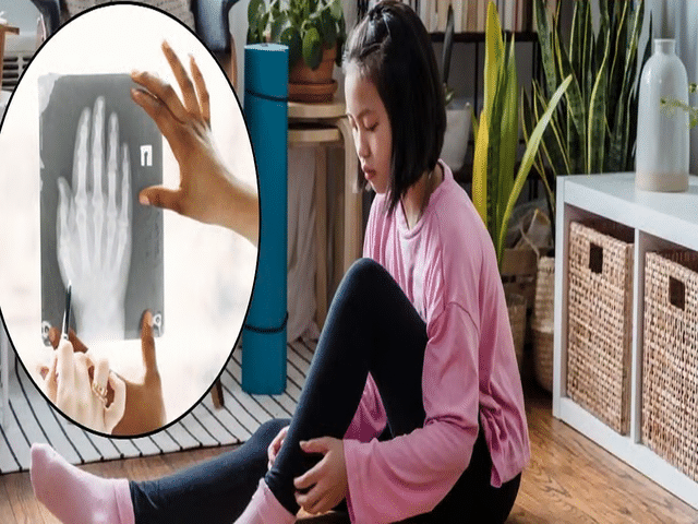 Osteoporosis in children: Can kids develop this bone disease too ...