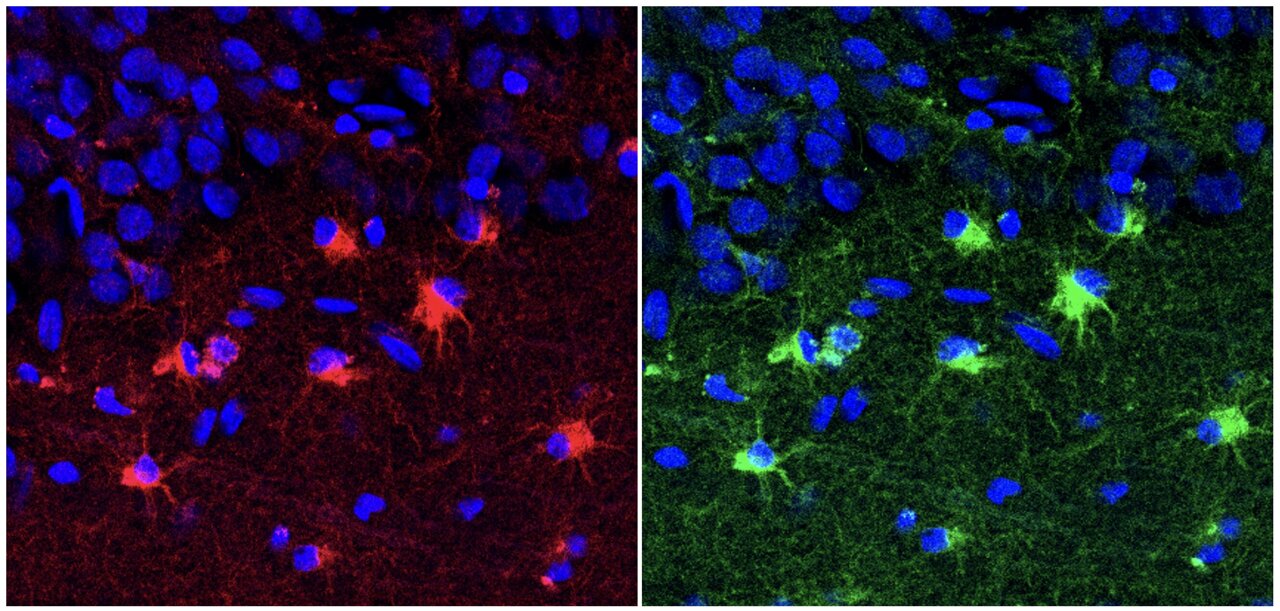 Immature brain support cells may be linked to human age-related ...