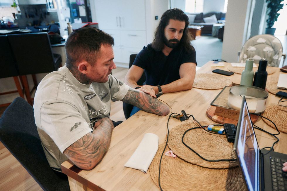 Under-skin implant controls prosthetic arms
