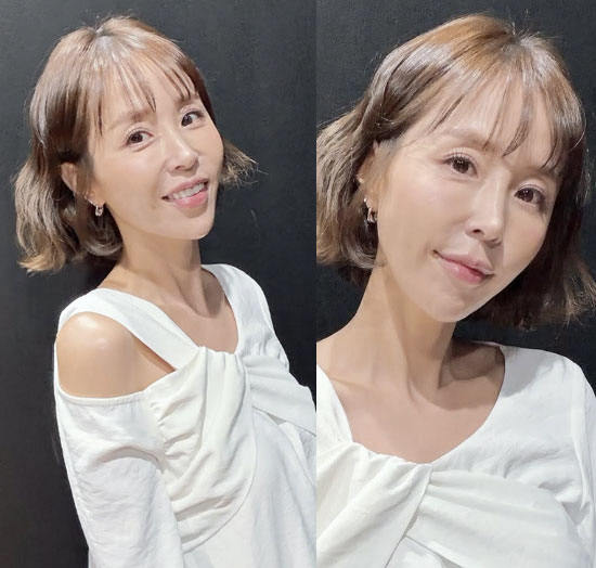 What happened to your face? Shin Ji looks gaunt, with her cheeks gone ...