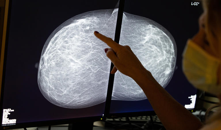 Spending 30 minutes less on this activity lowers cancer risk: study