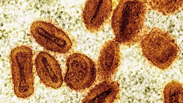 Health District reports first clade I mpox case in Clark County resident