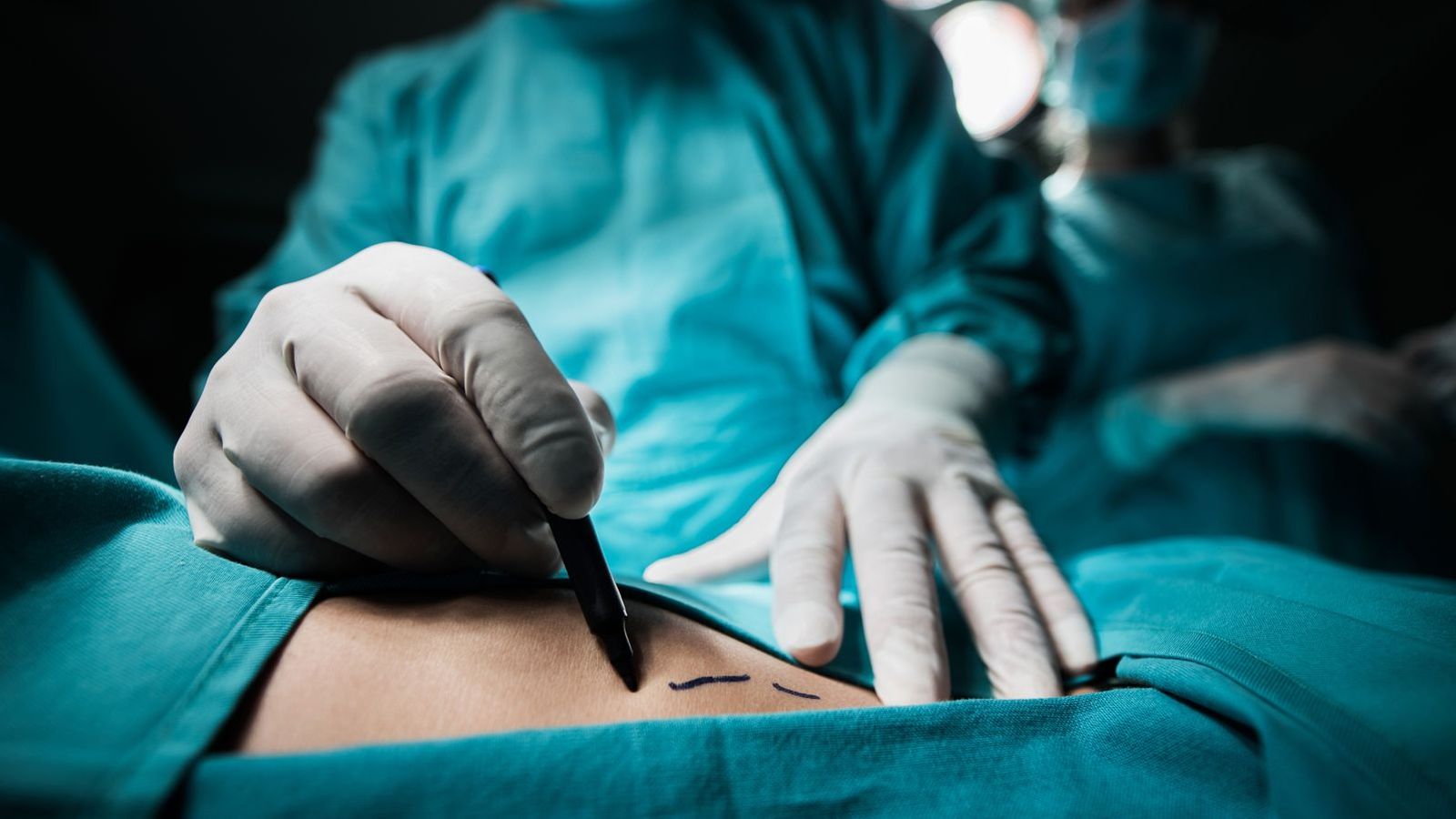 Tough new rules on Brazilian butt lifts and chemical peels proposed