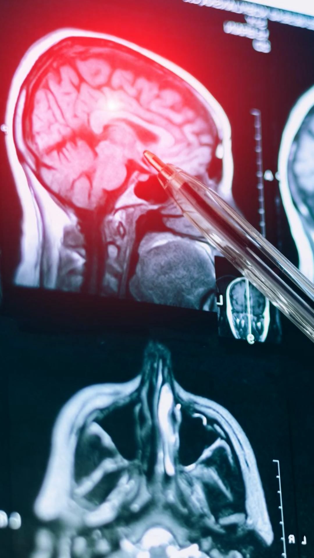 How can you stop brain shrinkage after 50?