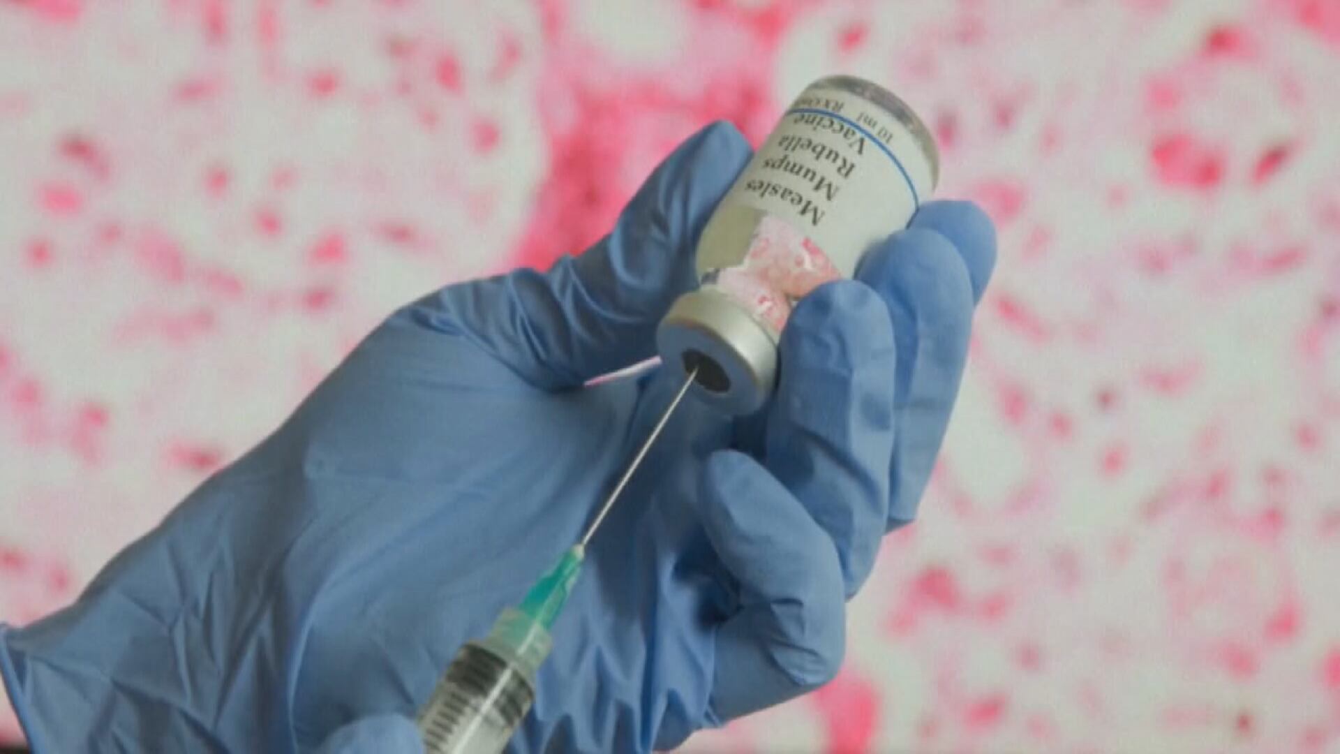 Measles cases rise across Missouri counties