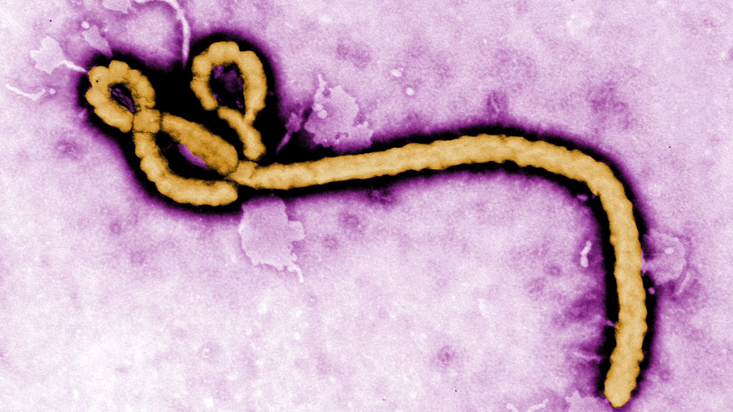 Another African country confirms Ebola case, becoming fifth affected by ...