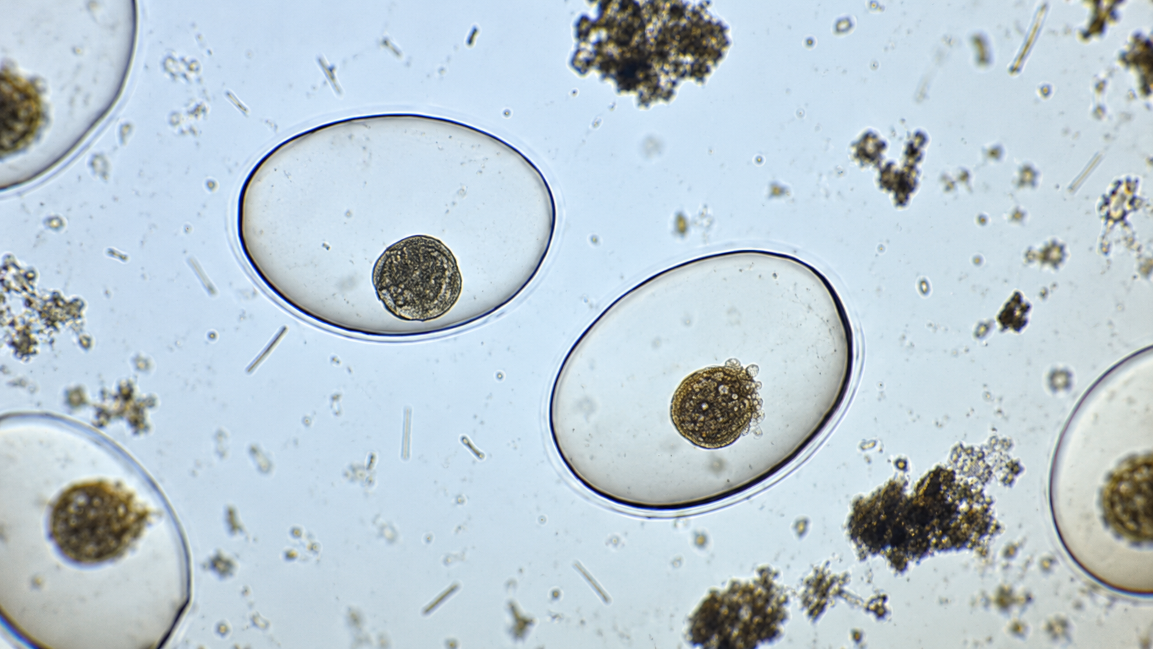 Bacteria, tiny creatures, and scientific experiments uncover a hidden ...