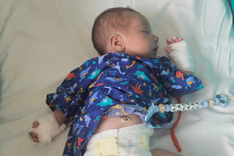 Baby starts chemotherapy at just one month old after rare eye cancer found