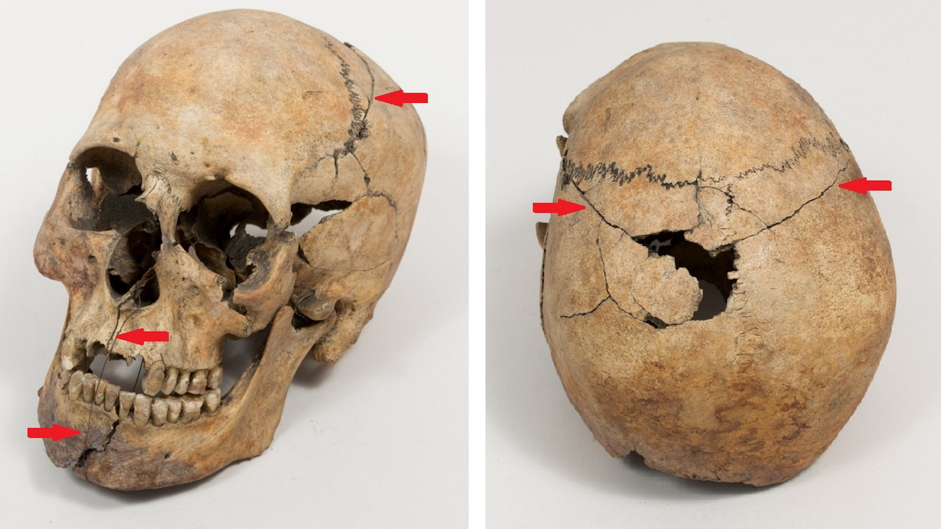 1,000-year-old skeleton found at Westminster Abbey may belong to ...