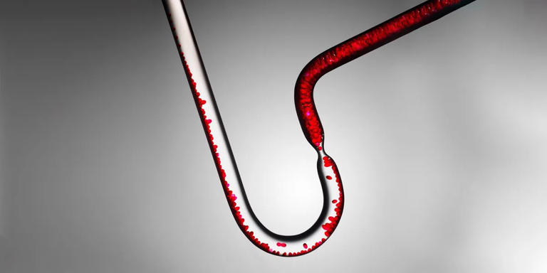 LDL-cholesterol verlagen kan simpel zijn: dit ontbijt is supergezond ...