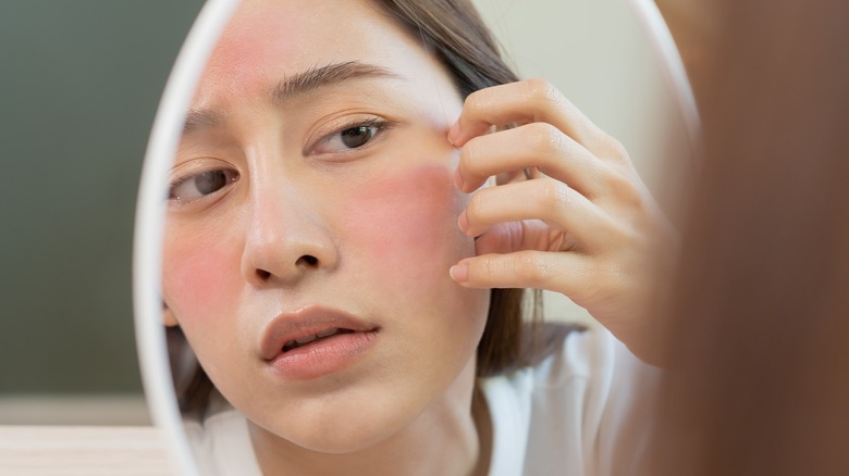 14 things you can do to get rid of your rash