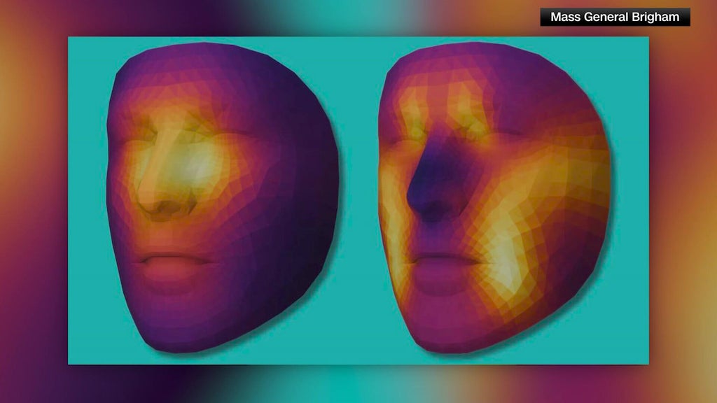 Upload a selfie, find out your biological age. New FaceAge AI tool ...