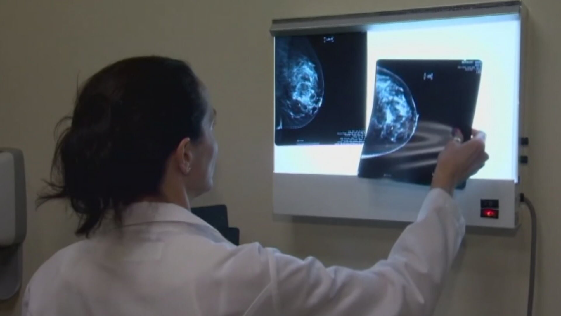 Doctor shares breast cancer risk factor many women may overlook