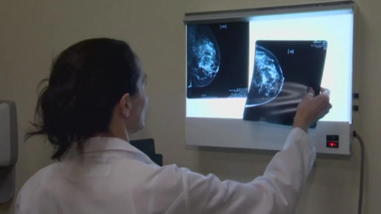Doctor shares breast cancer risk factor many women may overlook