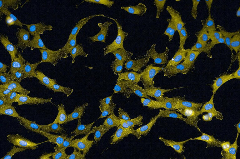 The hidden role of a cancer treatment target could explain toxic side ...